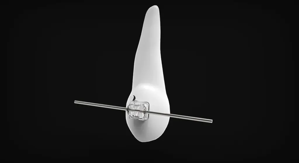 Stop Dental Discomfort: A Practical Guide to Common Horse Dental Problems and Prevention