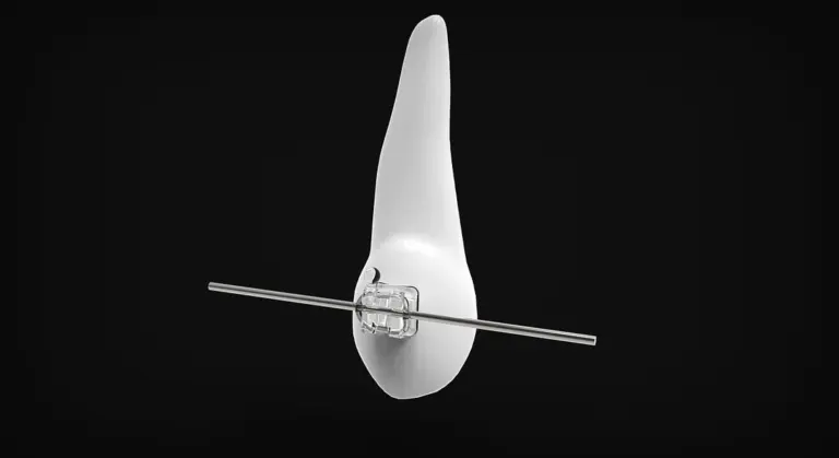 Close-up of a horse tooth with a dental mouth speculum used during an exam